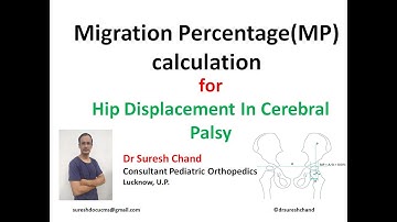 Migration Percentage calculation - cerebral palsy_ hip displacement using hip screen app