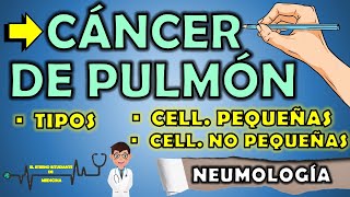 TIPOS DE CÁNCER DE PULMÓN NEUMOLOGÍA RESUMEN 📝👨🏻‍⚕️