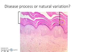 Dermatopathology (1) Dr/ Magda Assaf: stratum corneum