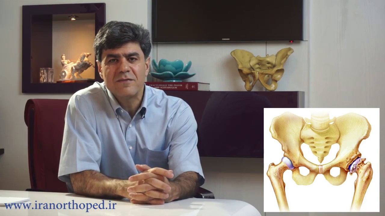 تعویض مفصل ران در ناحیه لگن چه تاثیری بر روی لنگش دارد