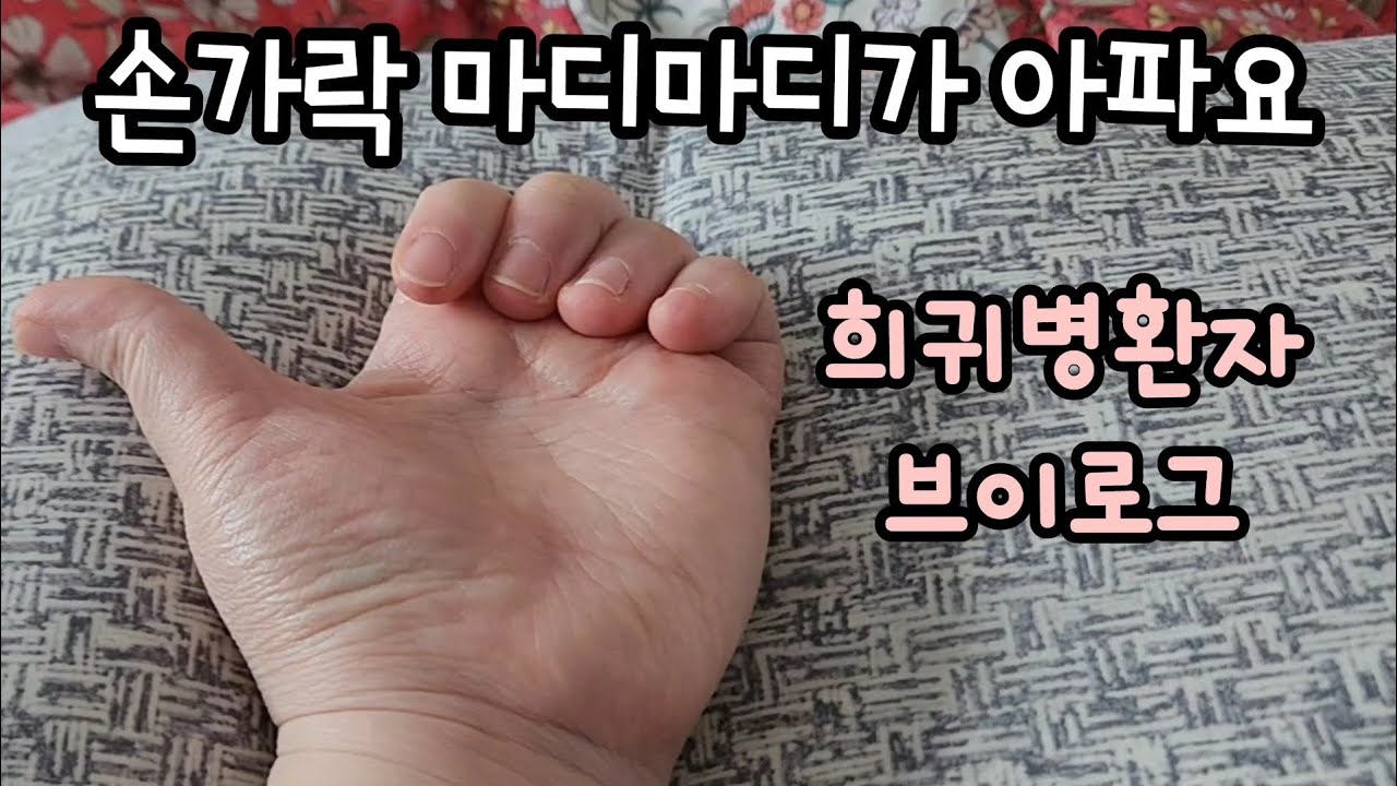 희귀병환자 브이로그 | 손가락 마디마디가 너무 아파요 | 자가면역질환, 희귀질환, 다발성 근육염 - YouTube