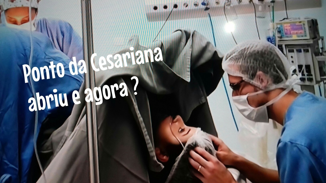 Pontos da cesárea abriu e agora ? || #aconteceucomigo - YouTube