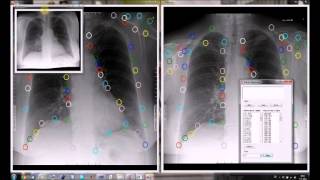 x-ray nonrigid registration