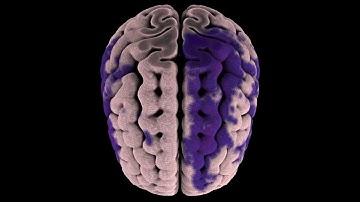 Anatomical Tracings of Lesions After Stroke (ATLAS) Release 1.1 Dataset