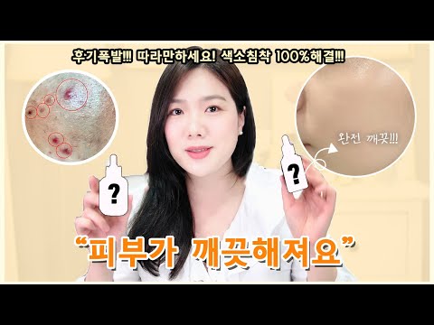 [All Time Favorite for PIH] How To Fix Postinflammatory Hyperpigmentation(PIH)💕
