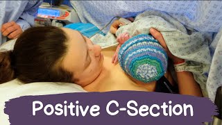 My Birth Story | Positive Gentle Csection