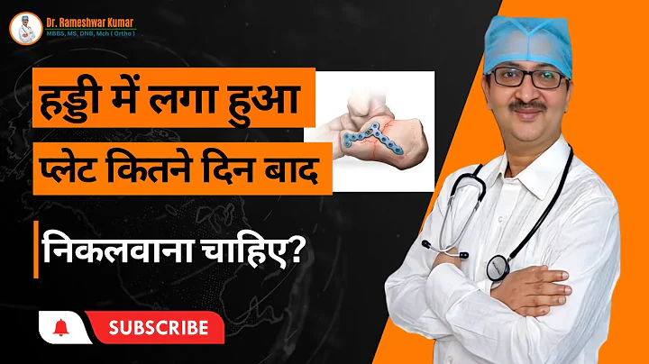 हड्डी में लगा हुआ प्लेट कितने दिन बाद निकलवाना चाहिए?