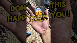 Cement Burns: The Hidden Dangers of Construction