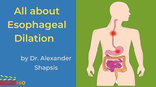 Esophageal Dilation at Atlantic Gastroenterology  Dr. Alexander Shapsis