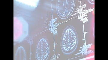 Addictions Counselor Core Skills, Part II: Diagnosing Substance Use Disorders Using DSM-5