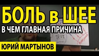 ВСД шея и шейный невроз | Боль в шее как снять | Боль в шее когда лежу и что с ней делать