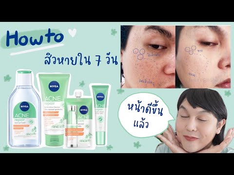 ♡ HOWTO ส่งสิวสู่ขิตอย่างถาวร เปลี่ยนหน้าสิว ให้ดีขึ้นใน 7 วัน ✨ ลดสิว + ลดรอย กับ NIVEA Acne Repair