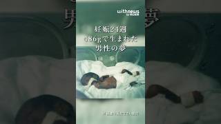 24年前、486グラムで生まれた男性の夢 #朝日新聞withnews