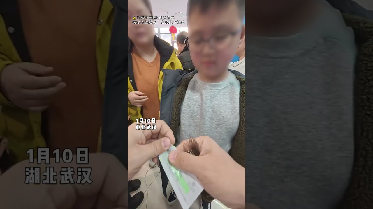 Painless flying needles in traditional Chinese acupuncture A record of Dr. Chen Song s day