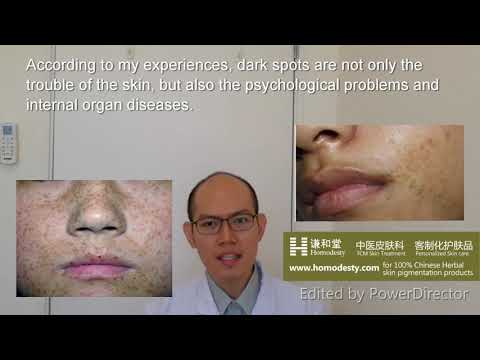 Lesson 4 : The POWERFUL WAYS to permanently make skin pigmentation, Melasma, Freckles dissapear
