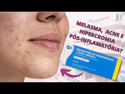 Vídeo: O valerato de betametasona ajuda a acne?