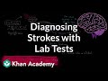 Diagnosing strokes with lab tests  circulatory system and disease  nclexrn  khan academy