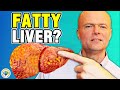 How To Reverse Fatty Liver Disease (You May Have A Fatty Liver)