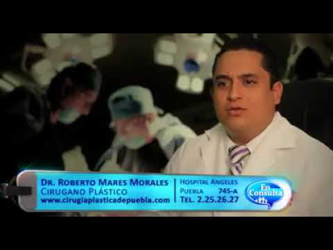 Roberto Carlos Mares Morales - Implantes Mamarios