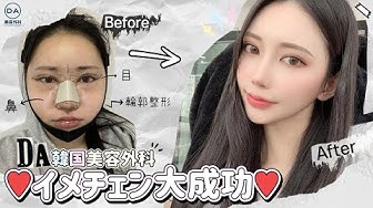 韓国整形 Youtube 韓国整形 Youtube