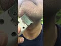 Skincare satisfying videos 🙄#hairremoval #remove #pimplepopping #blackheads #acne #asmr #natural