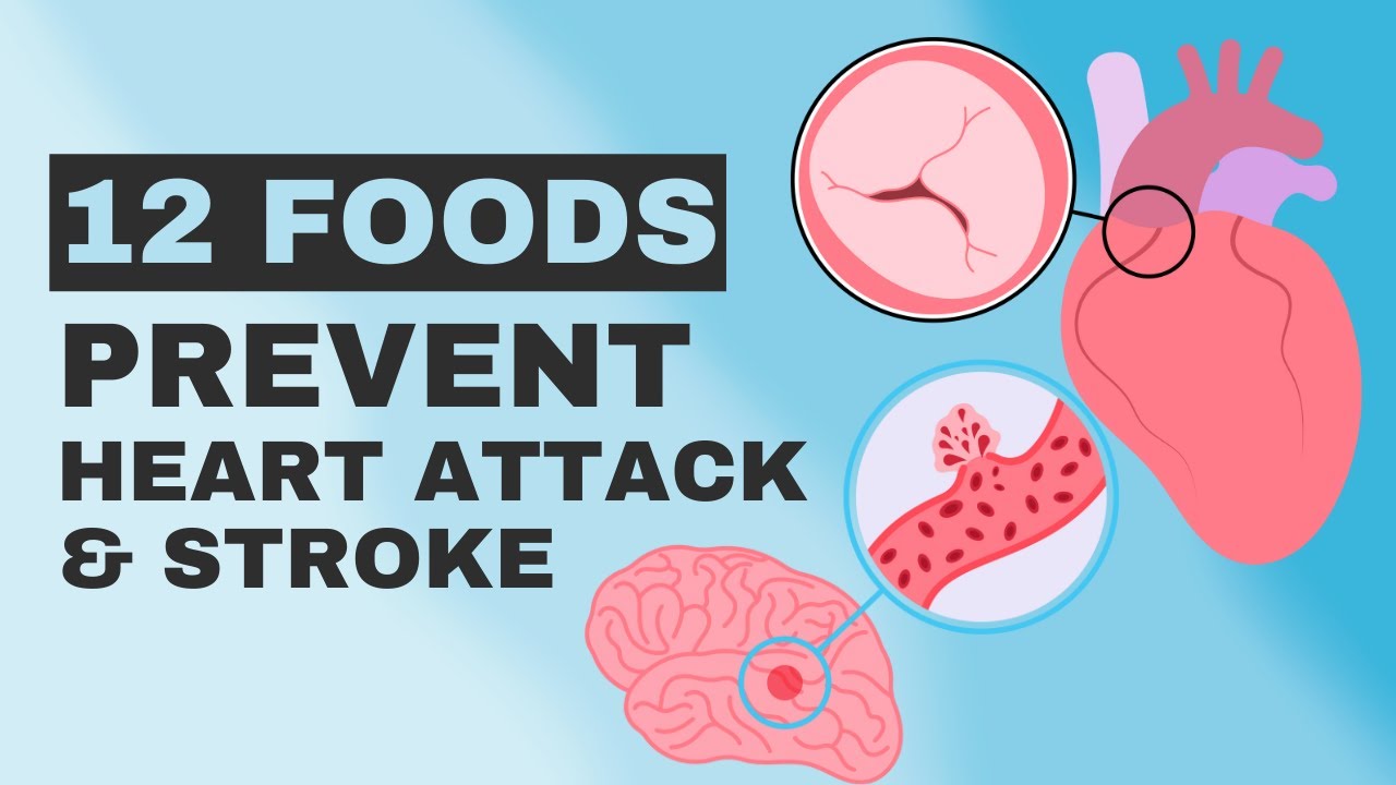 12 Natural Blood Thinning Foods That Prevent Blood Clot Heart Attack 