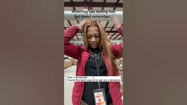 Everytime when my scalp itching bad…l’m also mad😤