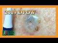 2019 Dilated Pore of Winer | Auburn Medical Group