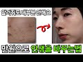 만원으로 잘생겨지는 방법. 남자들은 절대 모르는 피부과 관리법 공개