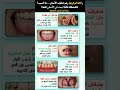 رائحة فم كريهة رغم تنظيف الأسنان الأسباب الخفية التي لا يعرفها الكثير اكسبلور تجميلاسنان معلومات
