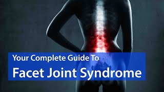 Is Facet Joint Syndrome Causing Your Back Pain? EVERYTHING YOU SHOULD KNOW