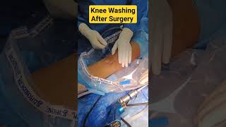 Post Ligament Knee Washing | घुटने की धुलाई ||