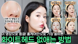 👃🏻코 옆! 입술 아래! 오돌토돌한 화이트헤드 홈케어로 없애는법✨️ 이 방법으로 박멸성공함👏🏻