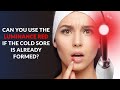 Can you use the luminance red if the cold sore is already formed cold sore laser treatment