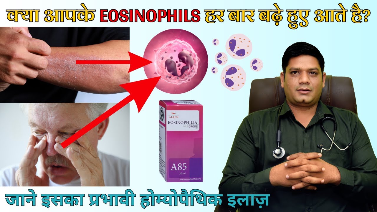 Homeopathic Treatment of High Eosinophils in Blood | Dr. Sunil Patidar 