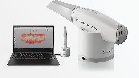 Dexis Intraoral Scanner