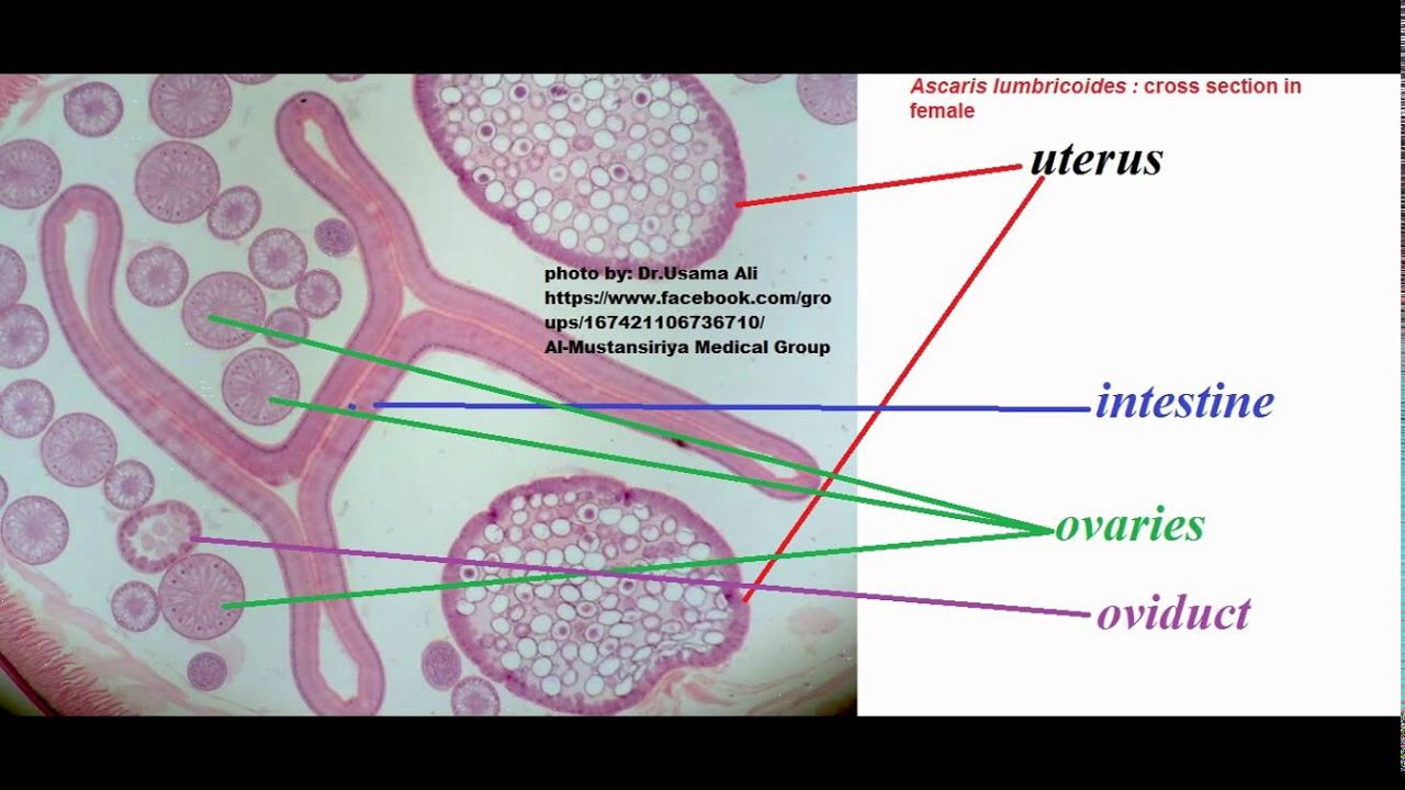 Ascaris lumbricoides male and female cross section with details - YouTube