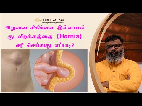 அறுவை சிகிச்சை இல்லாமல் குடலிறக்கத்தை சரி செய்வது எப்படி | How to correct hernia without surgery