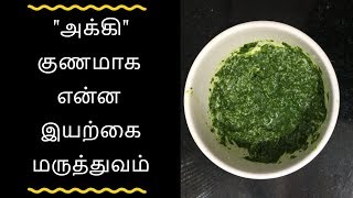 அக்கி குணமாக இயற்கை மருத்துவம் - Tamil health tips
