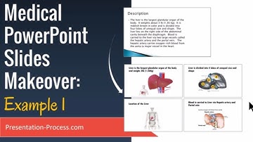 Medical PowerPoint Slides Makeover  (Example 1)