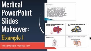 Medical PowerPoint Slides Makeover (Example 1)