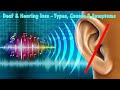 Deaf and Hearing loss - Types, Causes & Symptoms - Part 1 | Explained by krkumar Insights