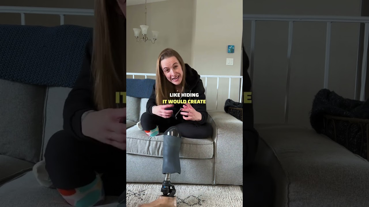 How I Hide My Prosthetic Leg Effectively