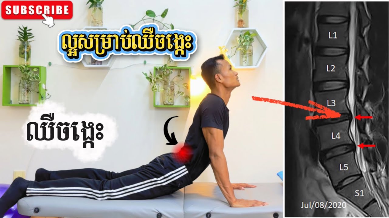 ✅ឈឺចង្កេះឬលានឌីសមើលវីឌីអូនេះ 