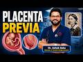 Placenta previa - obstetrics #NORCET Voogly #Sahusirclass 3031 #nursingofficerexams