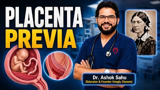 Placenta previa - obstetrics #NORCET Voogly #Sahusirclass 3031 #nursingofficerexams
