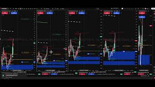 SPX 0DTE #0415  +~$18,000 9/25/2026