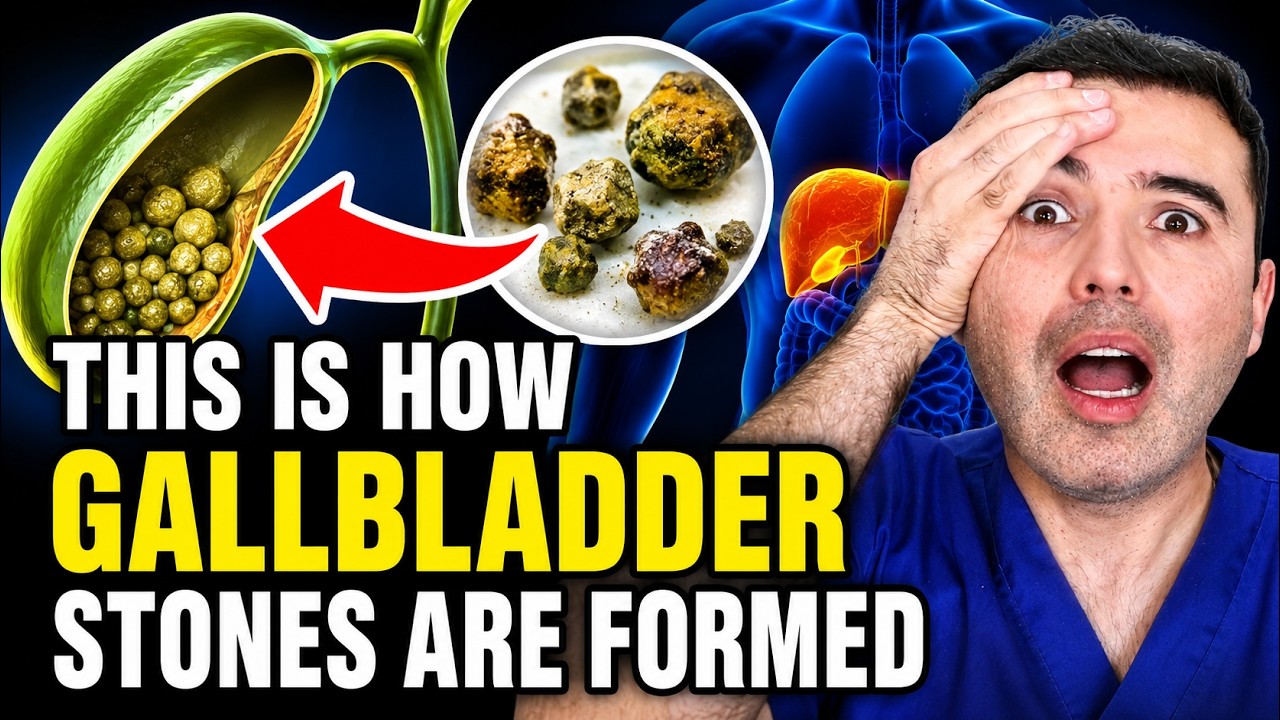 How To Eliminate Gallstones & Bile Sludge NATURALLY 🌿