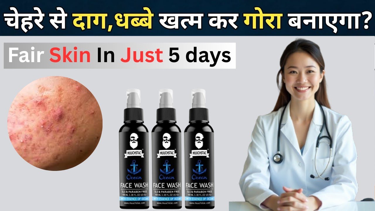 Muuchstac Face Wash Review | Best Face Wash for Men? Honest Results in Hindi 