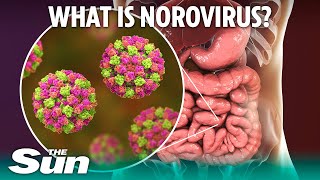 What is norovirus and how long does sickness bug last?